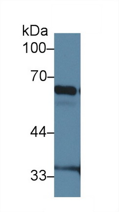 Polyclonal Antibody to Inhibitory Subunit Of NF Kappa B Zeta (IkBz)