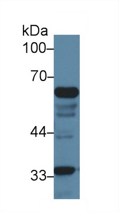 Polyclonal Antibody to Inhibitory Subunit Of NF Kappa B Zeta (IkBz)