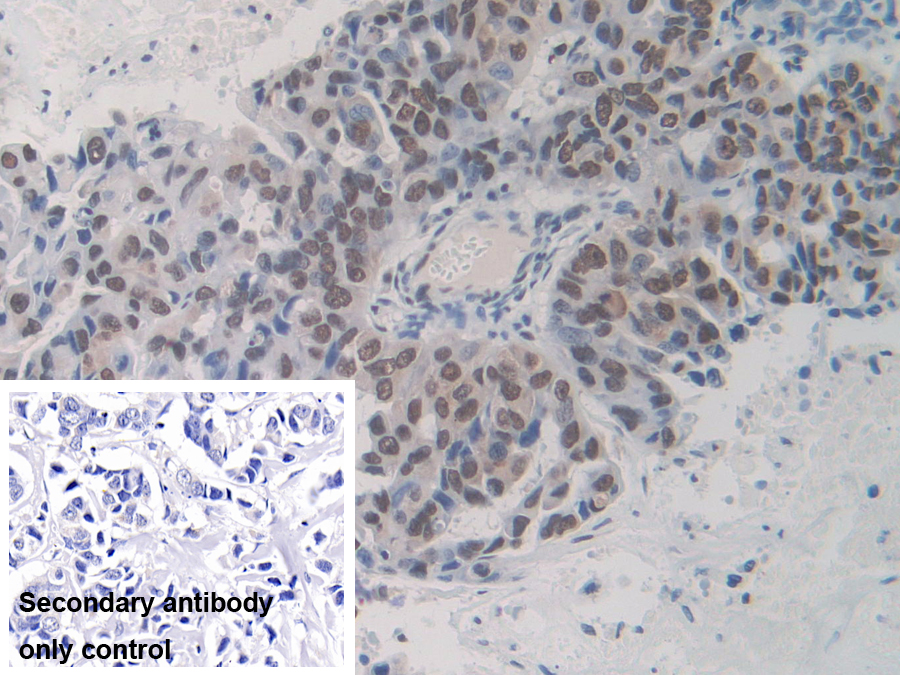 Polyclonal Antibody to Heterogeneous Nuclear Ribonucleoprotein A1 (HNRNPA1)