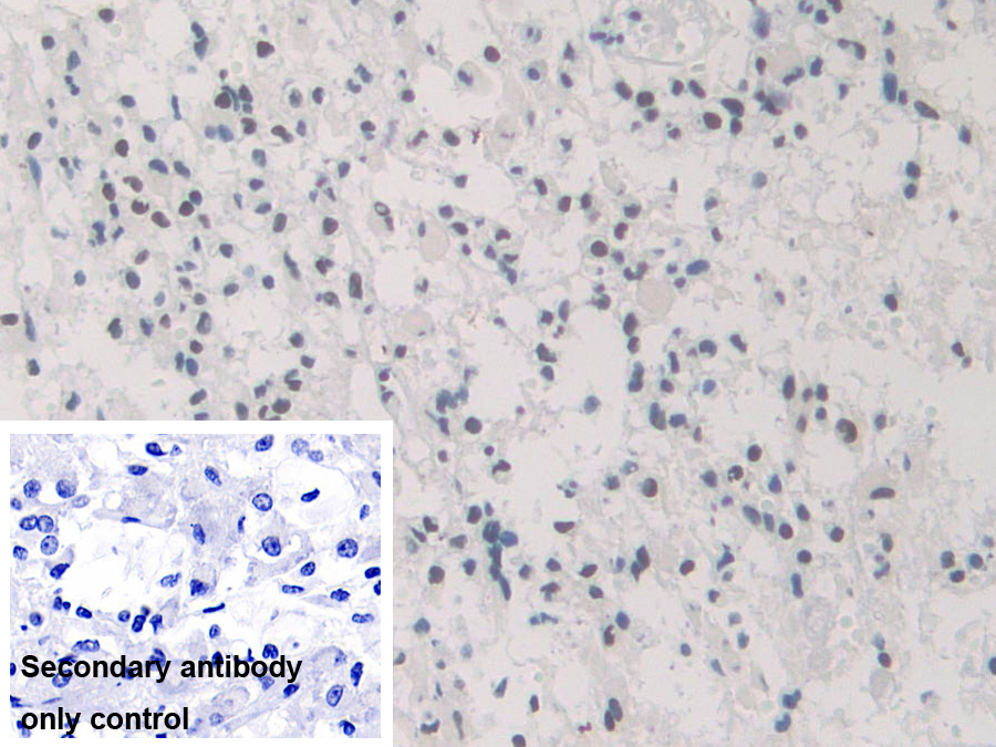 Polyclonal Antibody to Heterogeneous Nuclear Ribonucleoprotein A1 (HNRNPA1)