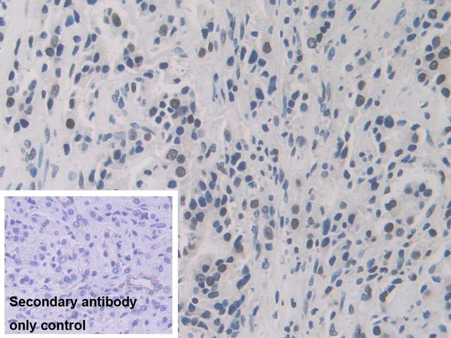 Polyclonal Antibody to Heterogeneous Nuclear Ribonucleoprotein A1 (HNRNPA1)