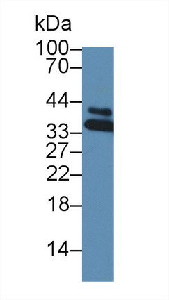 Polyclonal Antibody to Heterogeneous Nuclear Ribonucleoprotein A1 (HNRNPA1)