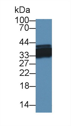 Polyclonal Antibody to Heterogeneous Nuclear Ribonucleoprotein A1 (HNRNPA1)