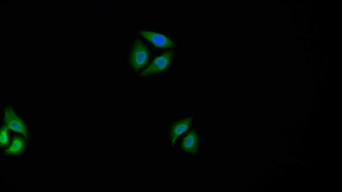 Polyclonal Antibody to Heterogeneous Nuclear Ribonucleoprotein A1 (HNRNPA1)