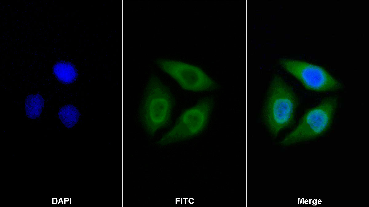 Polyclonal Antibody to Heterogeneous Nuclear Ribonucleoprotein A1 (HNRNPA1)