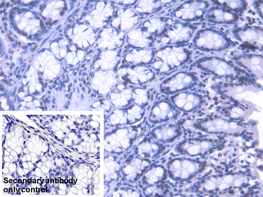 Polyclonal Antibody to Heterogeneous Nuclear Ribonucleoprotein A1 (HNRNPA1)