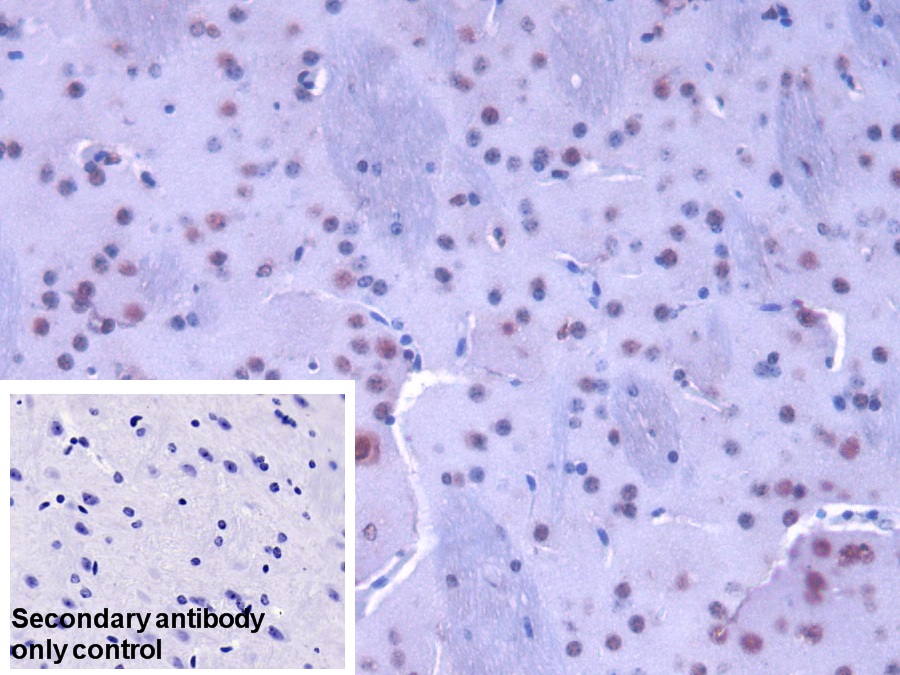 Polyclonal Antibody to Heterogeneous Nuclear Ribonucleoprotein A1 (HNRNPA1)