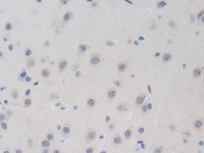 Polyclonal Antibody to Bromodomain Containing Protein 8 (BRD8)