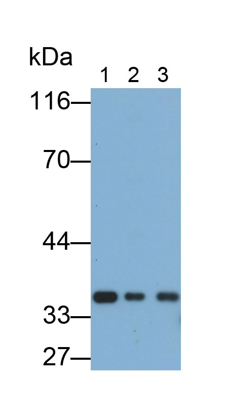 Polyclonal Antibody to Survival Motor Neuron Protein (SMN)