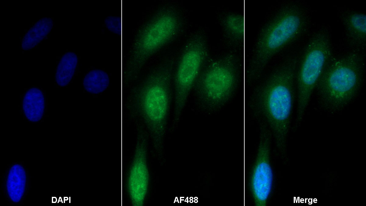 Polyclonal Antibody to Nucleoporin 62 (NUP62)