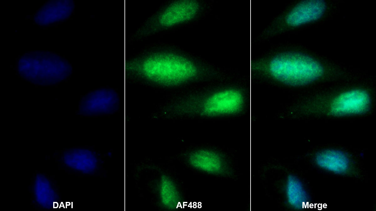 Polyclonal Antibody to Fusion (FUS)