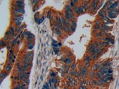 Polyclonal Antibody to Disrupted In Schizophrenia 1 (DISC1)