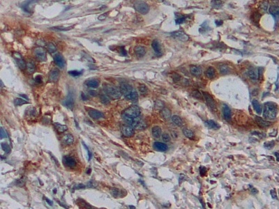 Polyclonal Antibody to Disrupted In Schizophrenia 1 (DISC1)