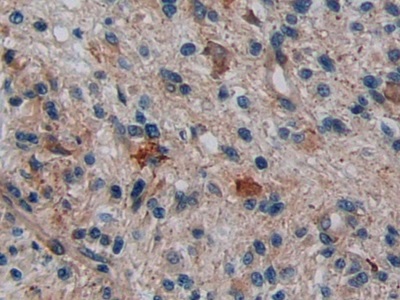 Polyclonal Antibody to Disrupted In Schizophrenia 1 (DISC1)