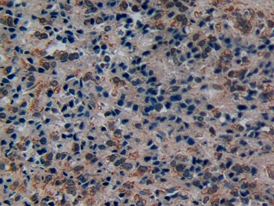 Polyclonal Antibody to Disrupted In Schizophrenia 1 (DISC1)