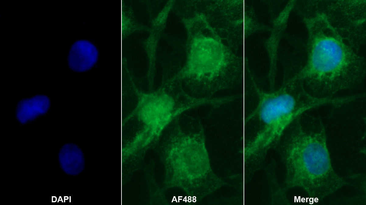 Polyclonal Antibody to Disrupted In Schizophrenia 1 (DISC1)