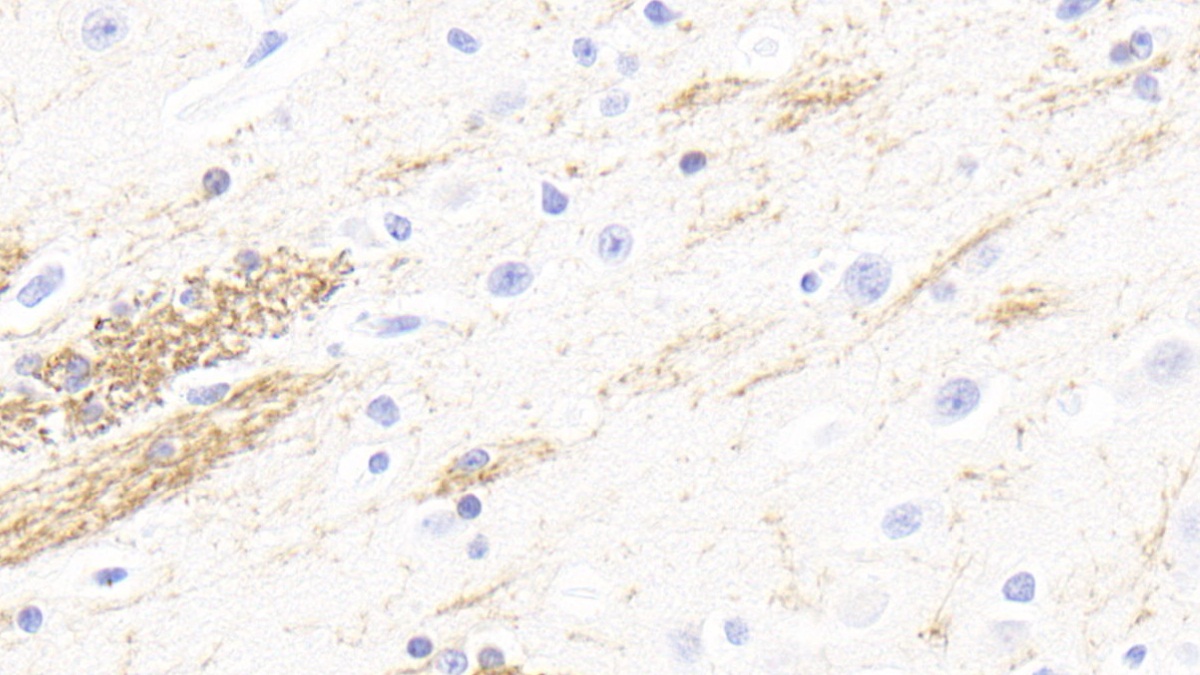 Polyclonal Antibody to 2',3'-Cyclic Nucleotide 3'-Phosphodiesterase (CNP)