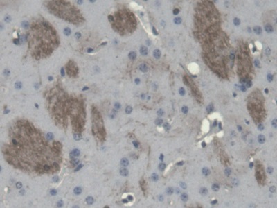 Polyclonal Antibody to 2',3'-Cyclic Nucleotide 3'-Phosphodiesterase (CNP)