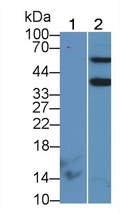 Polyclonal Antibody to Aminoadipate Semialdehyde Phosphopantetheinyl Transferase (AASDHPPT)