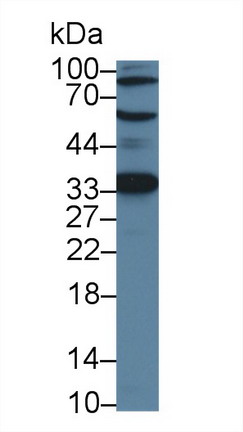 Polyclonal Antibody to Adrenocortical Dysplasia Homolog (ACD)