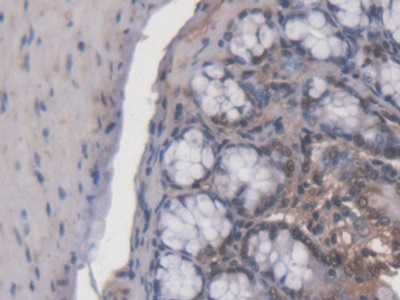 Polyclonal Antibody to Adrenocortical Dysplasia Homolog (ACD)