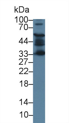 Polyclonal Antibody to Adrenocortical Dysplasia Homolog (ACD)