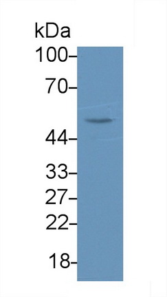 Polyclonal Antibody to Alpha-1,4-Galactosyltransferase (a4GALT)