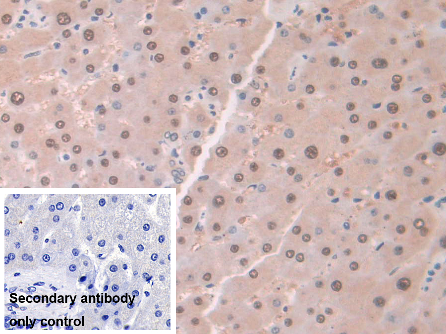 Polyclonal Antibody to Aminoacylase 1 (ACY1)