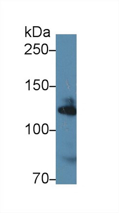 Polyclonal Antibody to Alpha Adducin (ADD1)