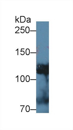 Polyclonal Antibody to Alpha Adducin (ADD1)