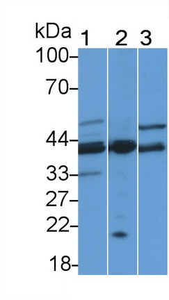 Polyclonal Antibody to Adenosine Kinase (ADK)