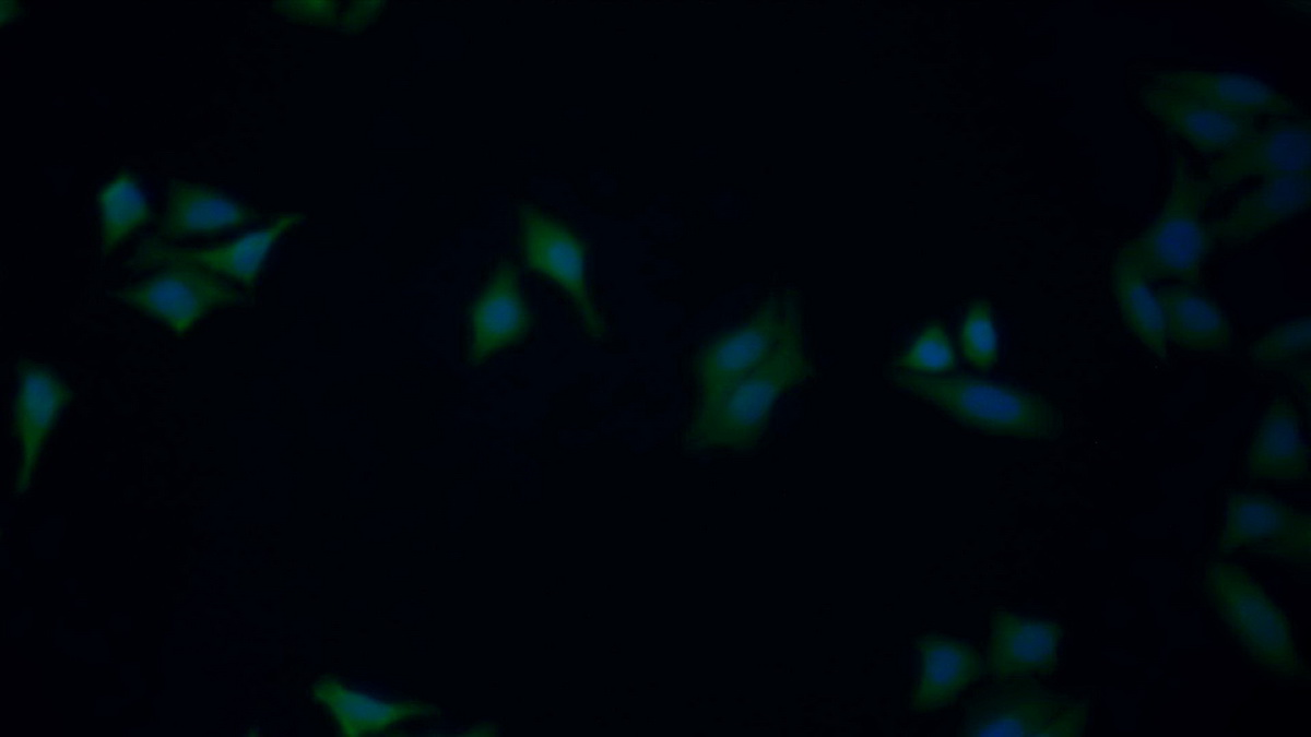 Polyclonal Antibody to Adenosine Kinase (ADK)