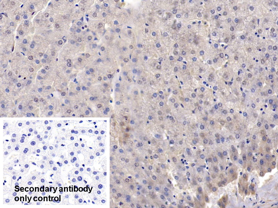 Polyclonal Antibody to Adenosine Kinase (ADK)