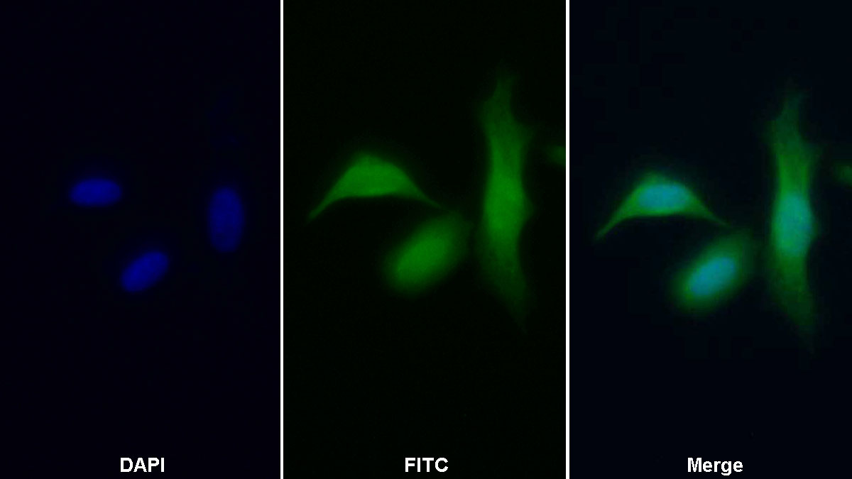 Polyclonal Antibody to Adenosine Kinase (ADK)