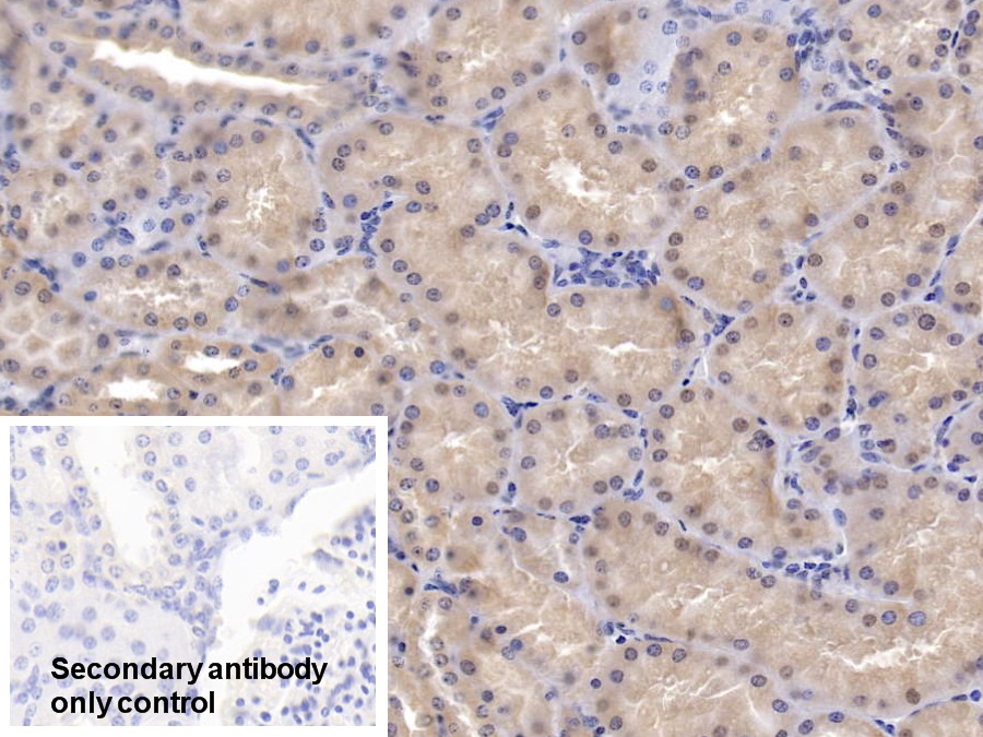 Polyclonal Antibody to Adenosine Kinase (ADK)