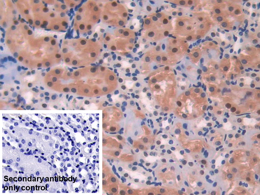 Polyclonal Antibody to Adenosine Kinase (ADK)