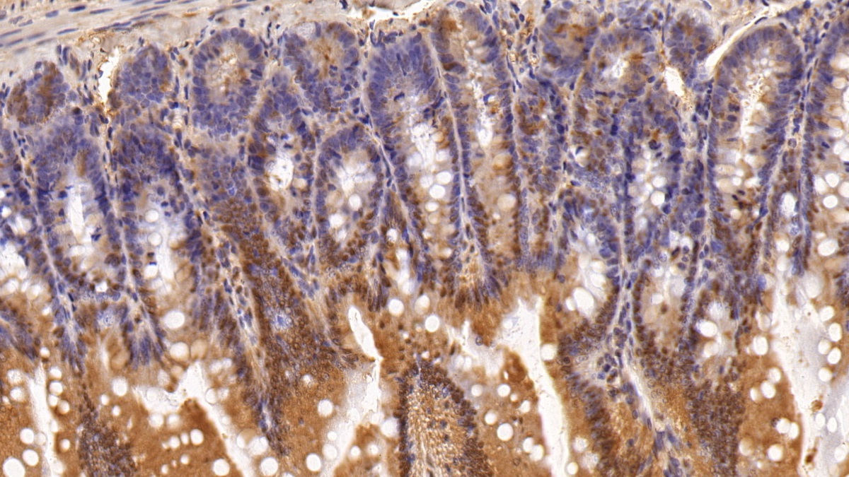 Polyclonal Antibody to Adhesion Regulating Molecule 1 (ADRM1)