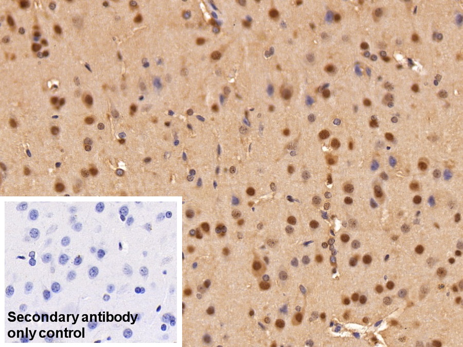 Polyclonal Antibody to Adhesion Regulating Molecule 1 (ADRM1)