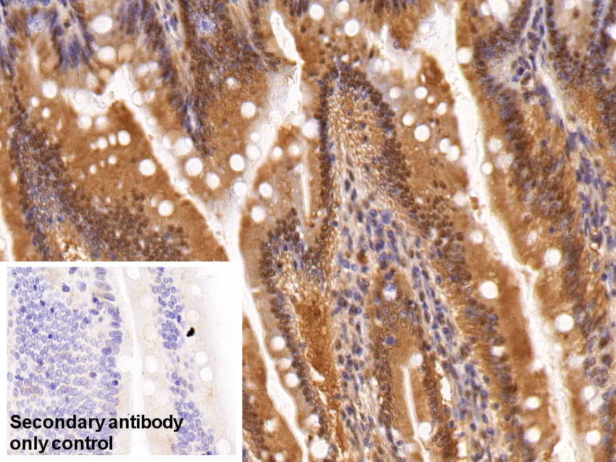 Polyclonal Antibody to Adhesion Regulating Molecule 1 (ADRM1)