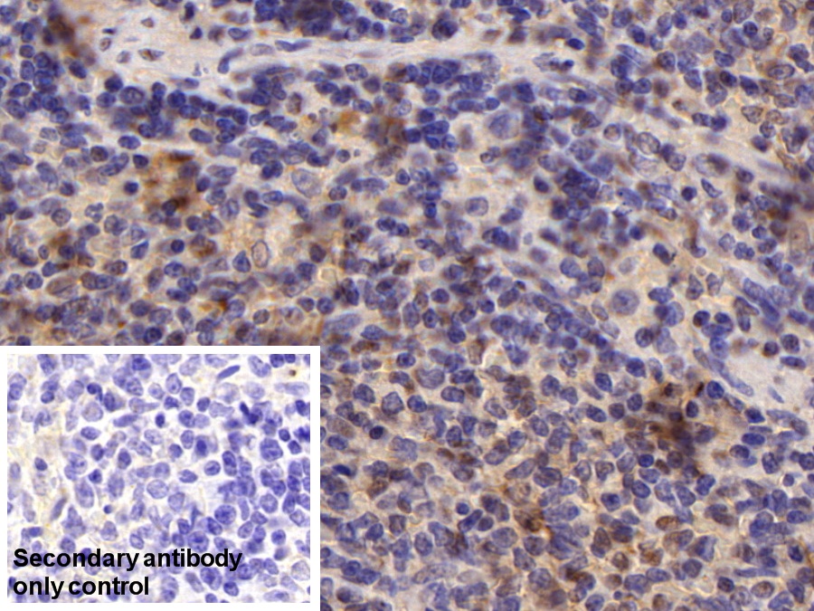 Polyclonal Antibody to Adhesion Regulating Molecule 1 (ADRM1)