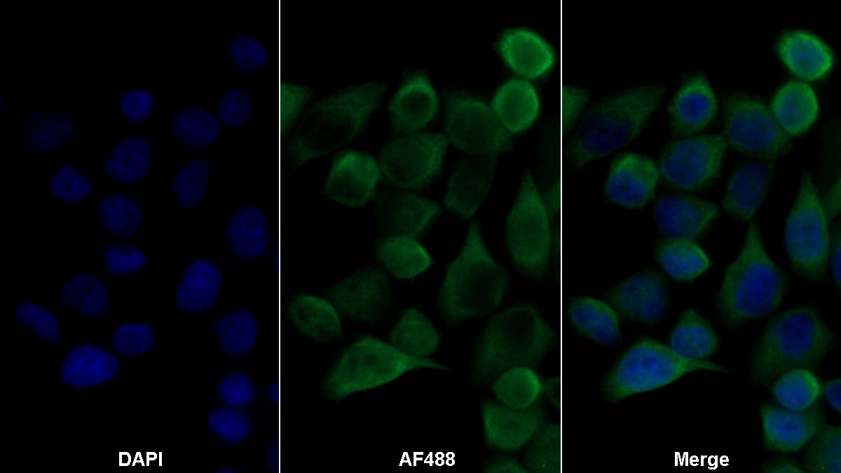 Polyclonal Antibody to Adhesion Regulating Molecule 1 (ADRM1)