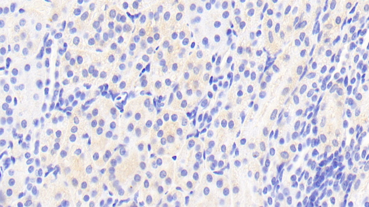 Polyclonal Antibody to Afamin (AFM)