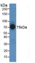 Polyclonal Antibody to Afamin (AFM)