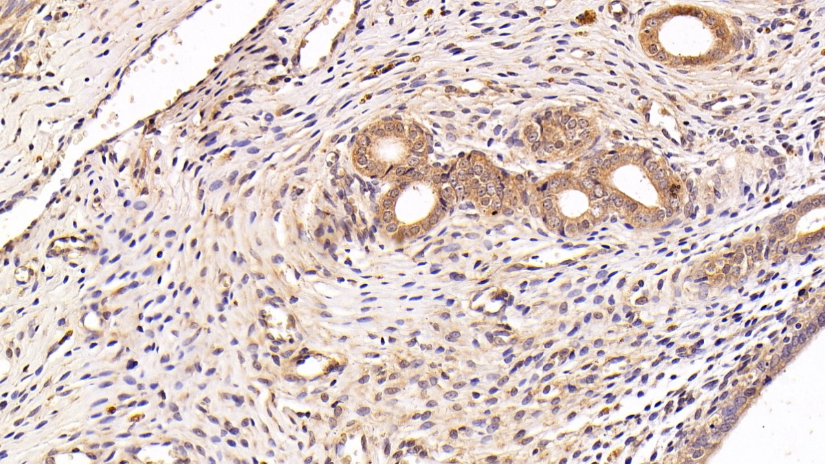 Polyclonal Antibody to Anterior Gradient 2 (AGR2)