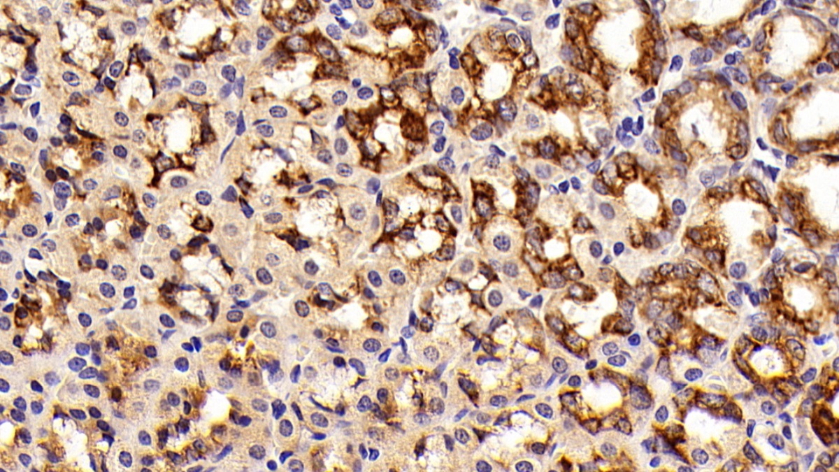 Polyclonal Antibody to Anterior Gradient 2 (AGR2)