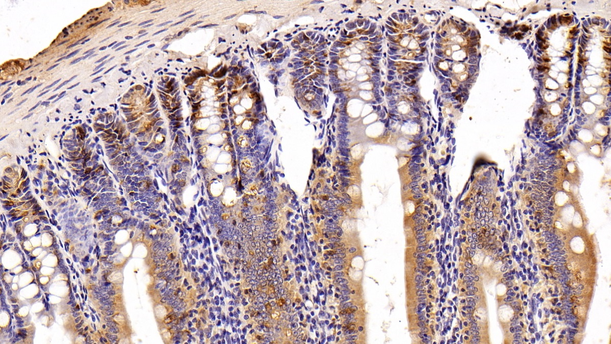 Polyclonal Antibody to Anterior Gradient 2 (AGR2)