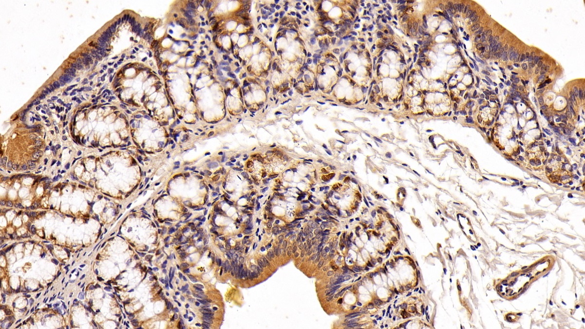 Polyclonal Antibody to Anterior Gradient 2 (AGR2)