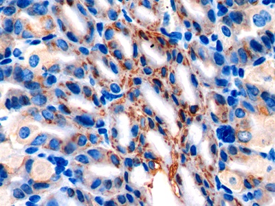 Polyclonal Antibody to Anterior Gradient 2 (AGR2)