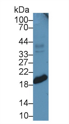 Polyclonal Antibody to Anterior Gradient 2 (AGR2)