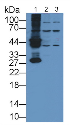 Polyclonal Antibody to Alanine Glyoxylate Aminotransferase (AGXT)